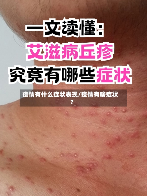 疫情有什么症状表现/疫情有啥症状?-第2张图片